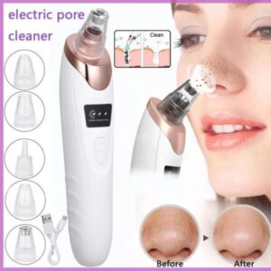 Electric Blackhead Remover Vacuum – Deep Pore Cleaner for Face & Nose